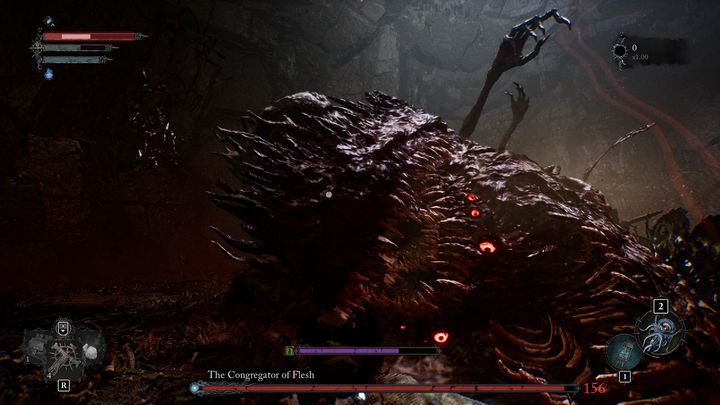 Wenn Sie versuchen, den Boss anzugreifen, konzentrieren Sie sich auf sein Bein – Lords of the Fallen: Congregator of Flesh – Boss, wie kann man ihn besiegen?  - Bosse – Lords of the Fallen Guide